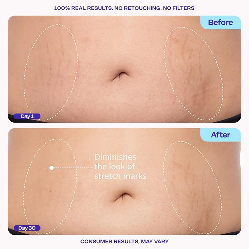Tighten & Smooth Belly Cream, MicroTight4 Complex Body Firming Lotion for Loose Skin